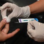 test hiv
