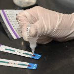 test hiv