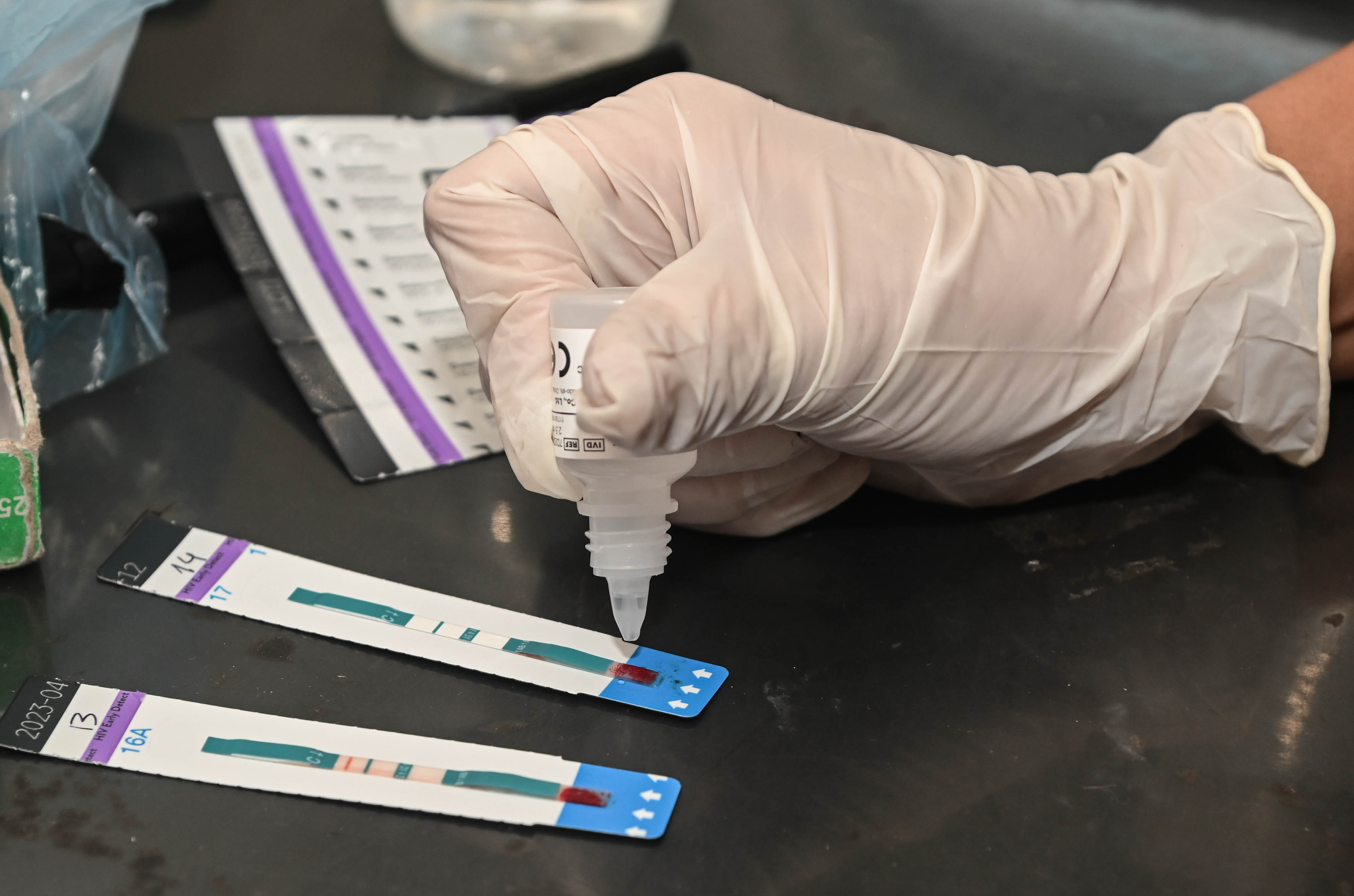 test hiv